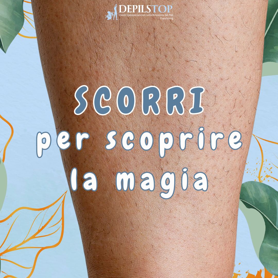 Depilstop Treviso